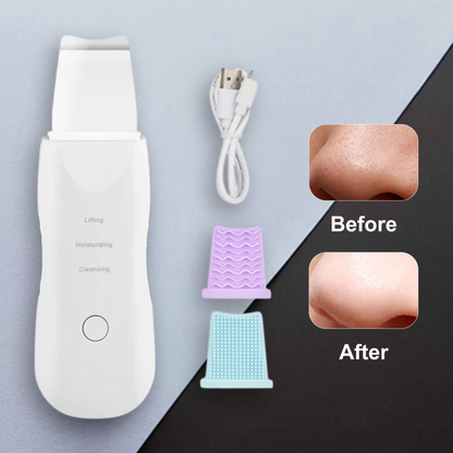 Ultrasonic Skin Scrubber