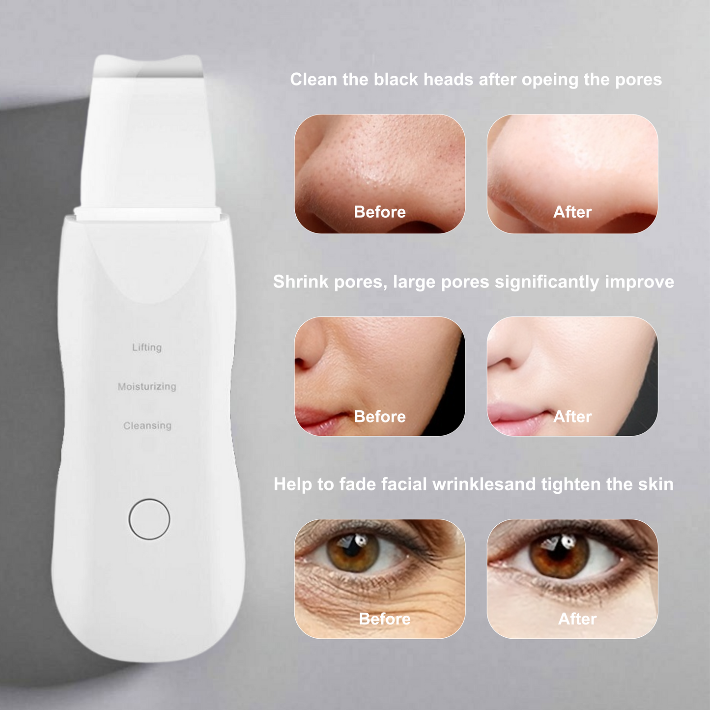 Ultrasonic Skin Scrubber